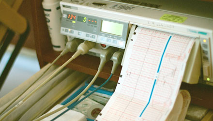 Hositpatl heart rate monitor printing heart rate